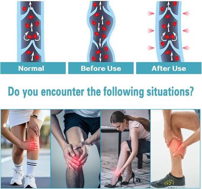 Open Toe Graduated Compression Stockings 20–30 mmHg