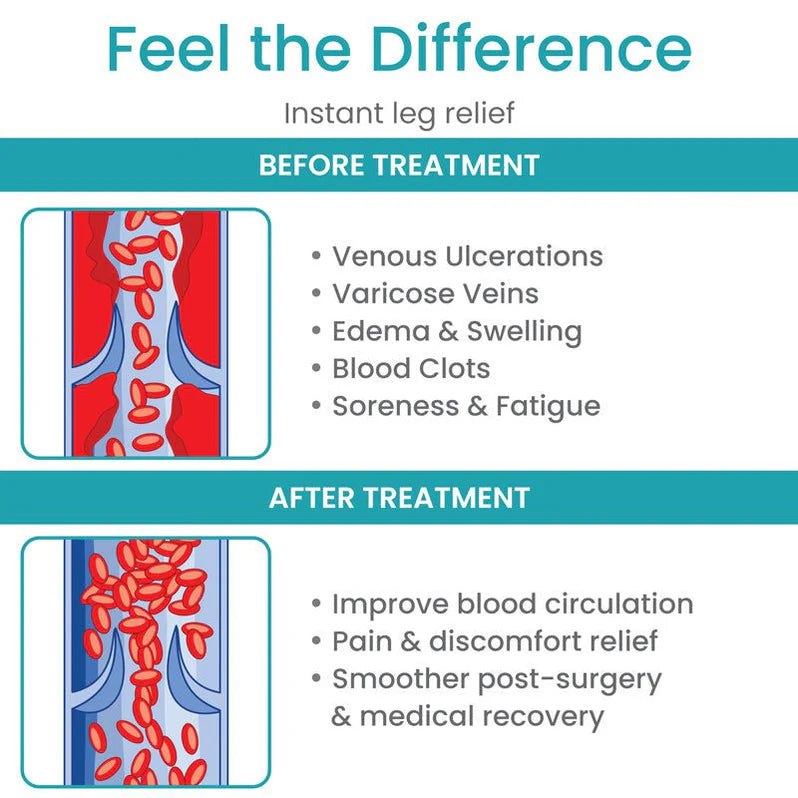 Waist High Compression Pantyhose